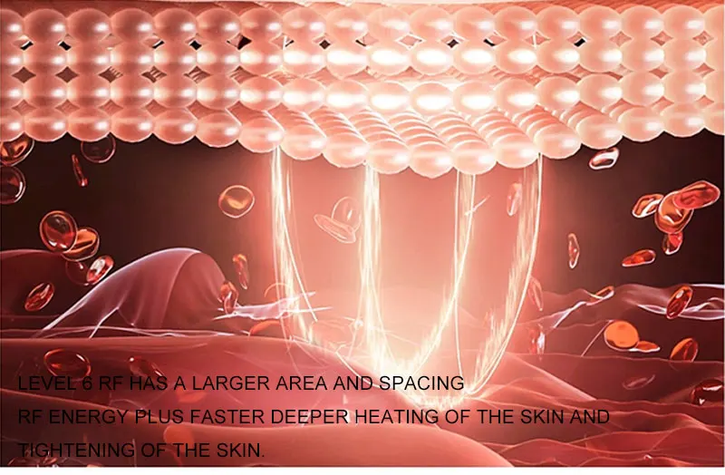 BrightLift RF+EMS Skin Sculptor – Targeted Tightening for Face & Body at Home - Image 13