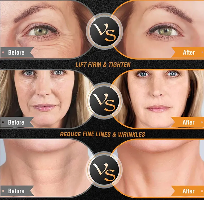 BrightLift RF+EMS Skin Sculptor – Targeted Tightening for Face & Body at Home - Image 17