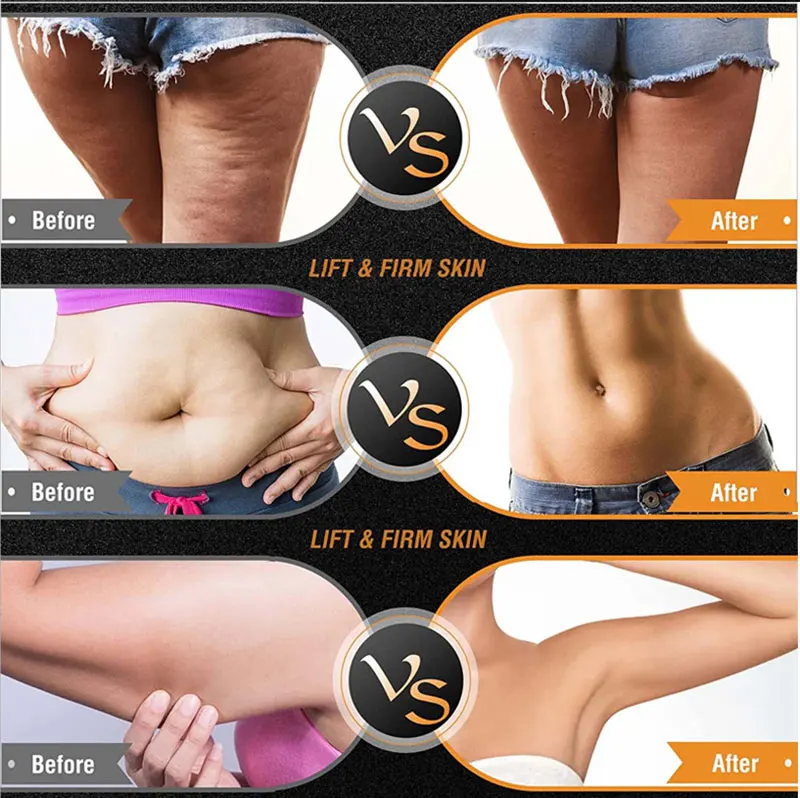 BrightLift RF+EMS Skin Sculptor – Targeted Tightening for Face & Body at Home - Image 18